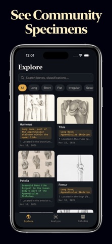 Bone Identifier iPhone screenshot