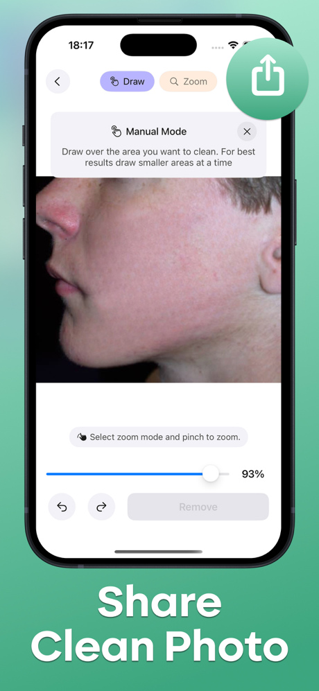 Acne Remover - Pimple Eraser screenshot 6
