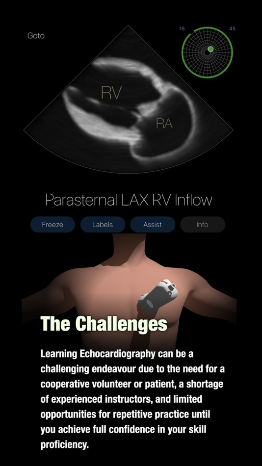 #2. TTE PoCUS Simulator (iOS) 由: Eltjo Haselhoff