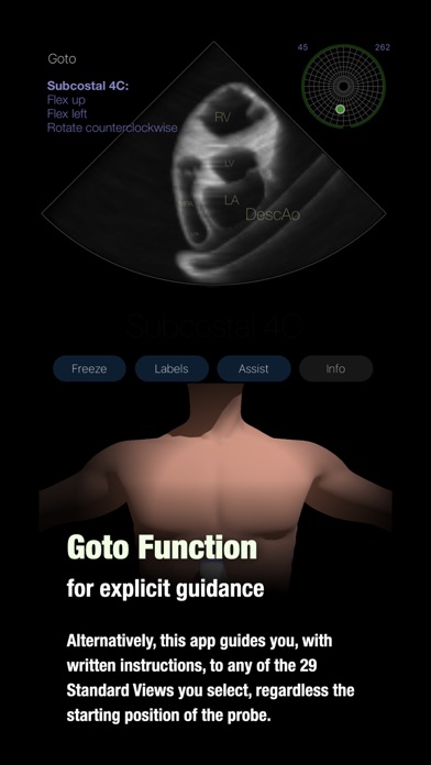 TTE PoCUS Simulator Screenshot