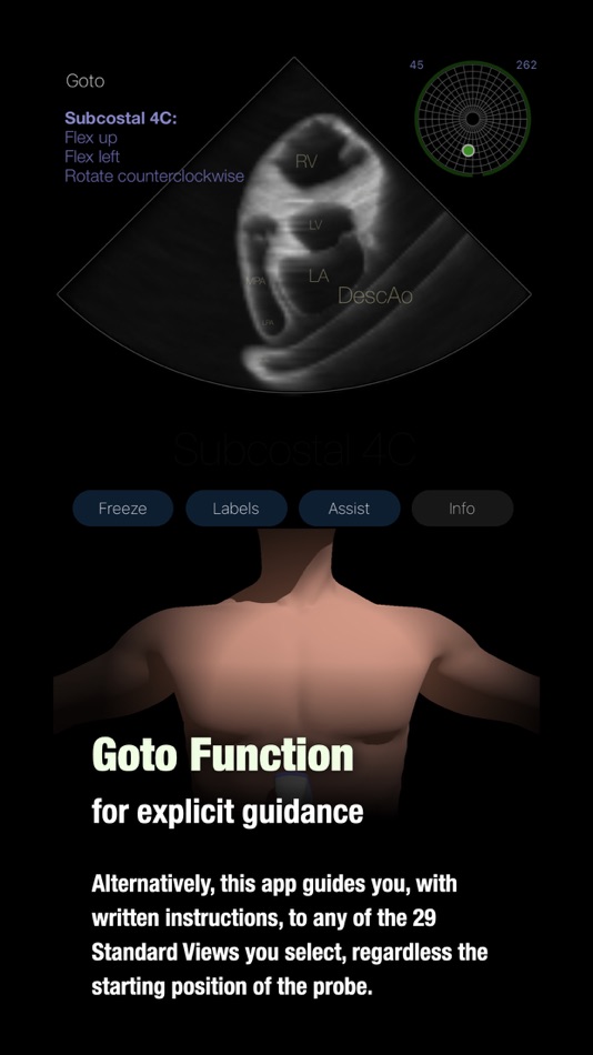 #5. TTE PoCUS Simulator (iOS) 由: Eltjo Haselhoff