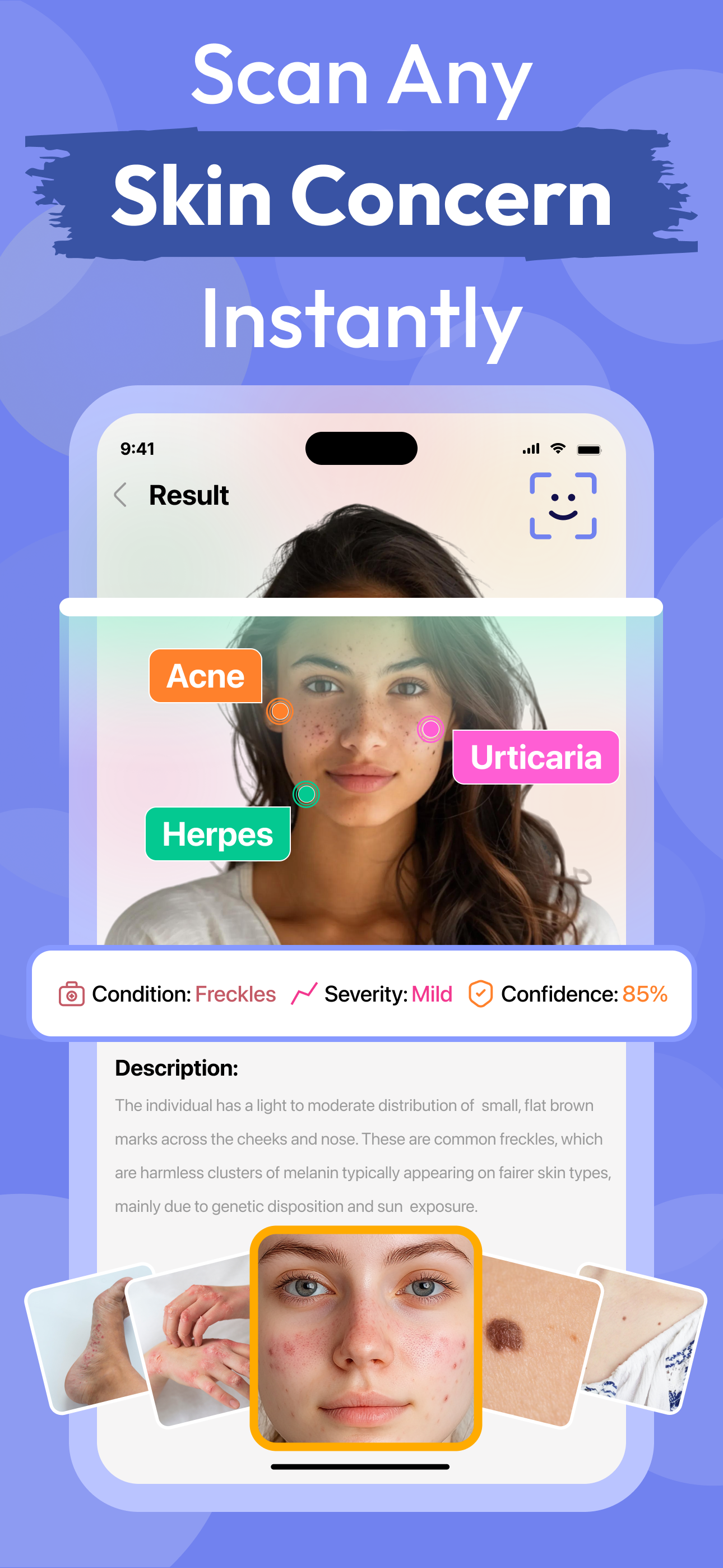 AI Skin Care Scanner・Acne Safe