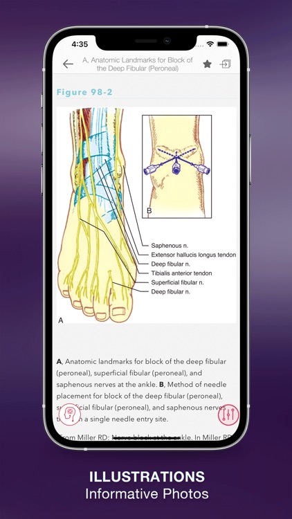 Faust's Anesthesiology Review screenshot-3