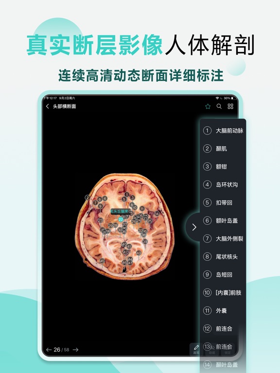 掌上3D解剖 iPad screenshot 5 - Medical app