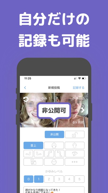 アトピー見える化アプリ-アトピヨ screenshot-3
