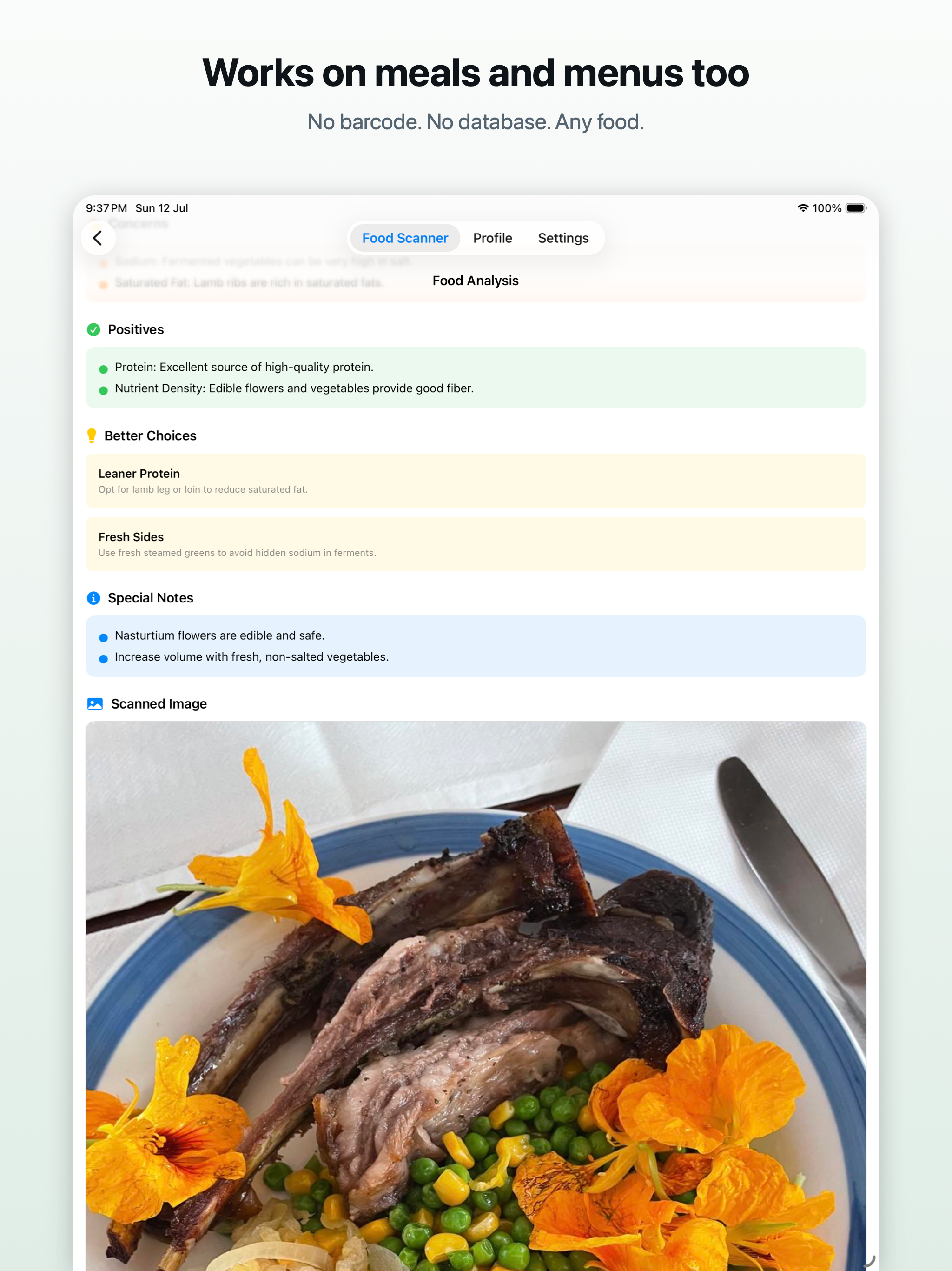 Food Signal: Scan & Stay Safe screenshot 13