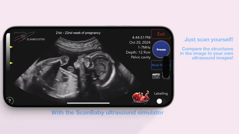 ScanBaby learn baby ultrasound screenshot 3 of 8