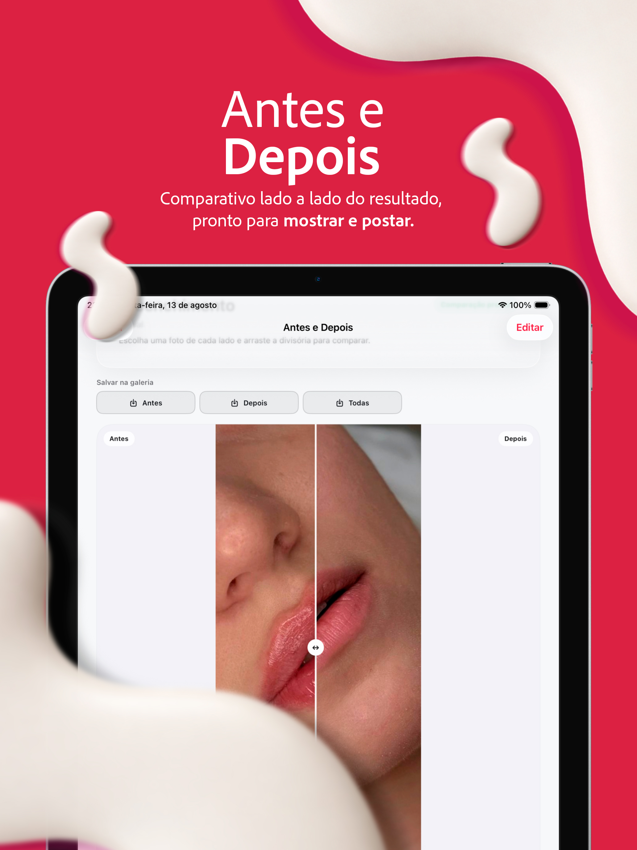 SkinPRO screenshot 12