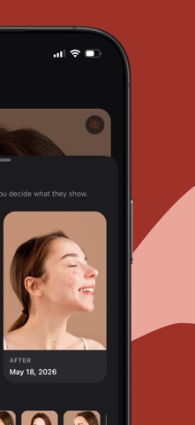 Acne Tracker: Skin Journal Screenshot 5 of 10