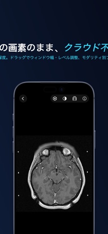 Lumen — DICOM ビューア のスクリーンショット