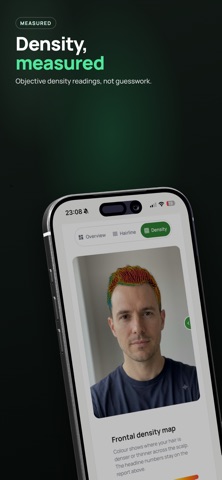 Trichometrics: Hair Loss AI screenshot