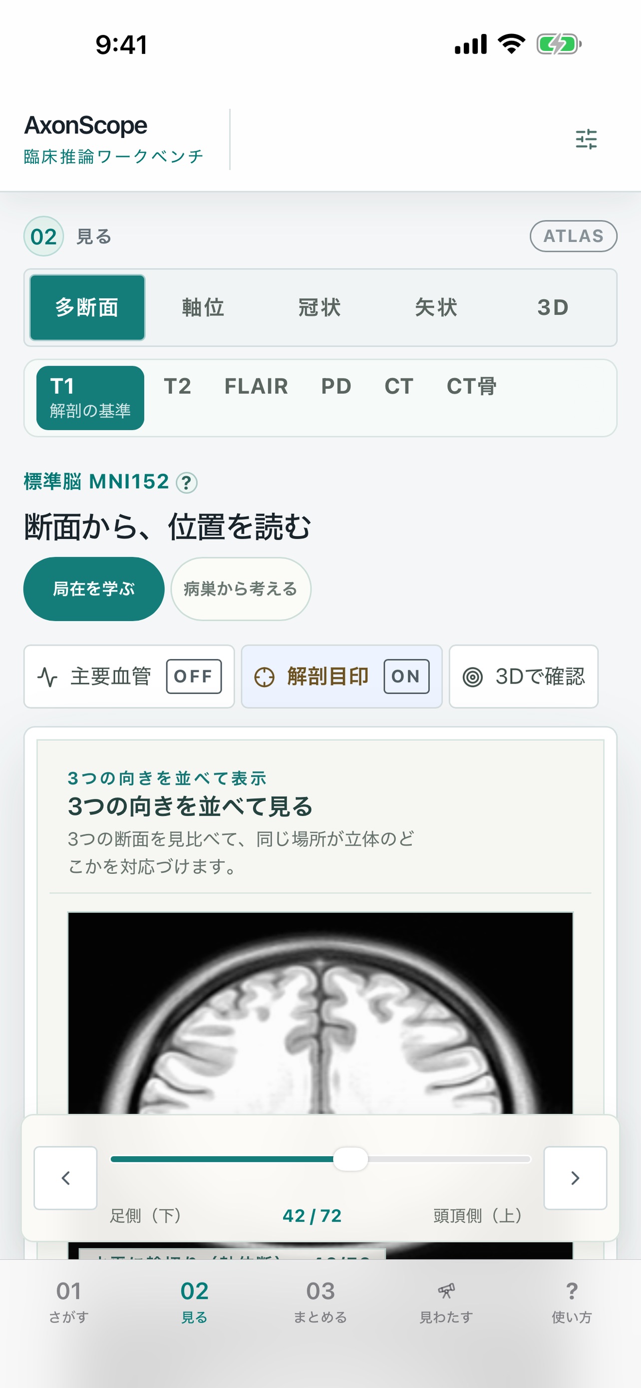 Screenshot 1 of AxonScope 脳画像と症状をつなぐ