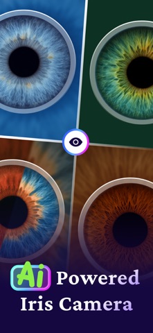 Iris Photo & Eye Color: eyeAI screenshot