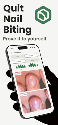 Stop Nail Biting: Nonyxa screenshot 1