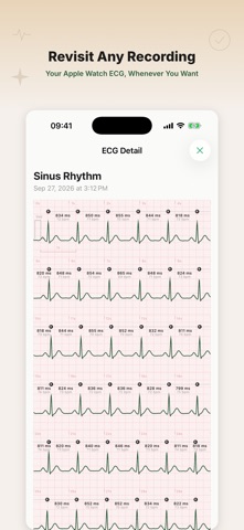 CardioWatch Pro Screenshot 7 of 7
