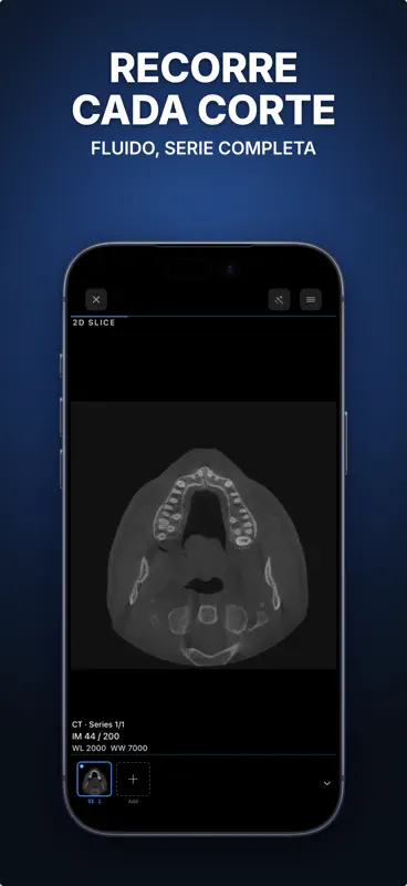 Ossidex: Visor DICOM, TAC, RM screenshot 6 of 6