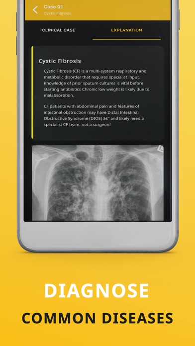 Chest X-ray (CXR) Made Easy Screenshot