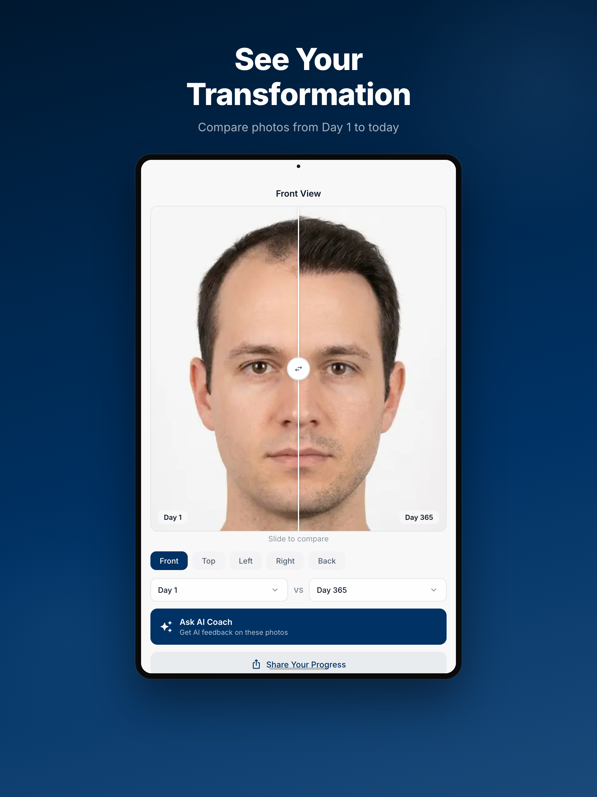 HairGrowth: Transplant Tracker screenshot 8