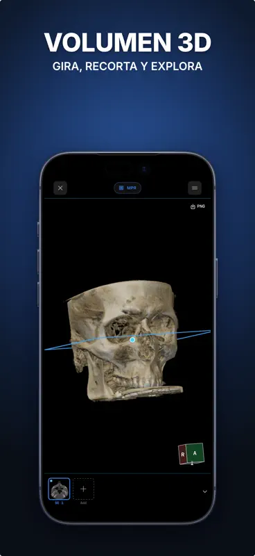 Ossidex: Visor DICOM, TAC, RM screenshot 3 of 6