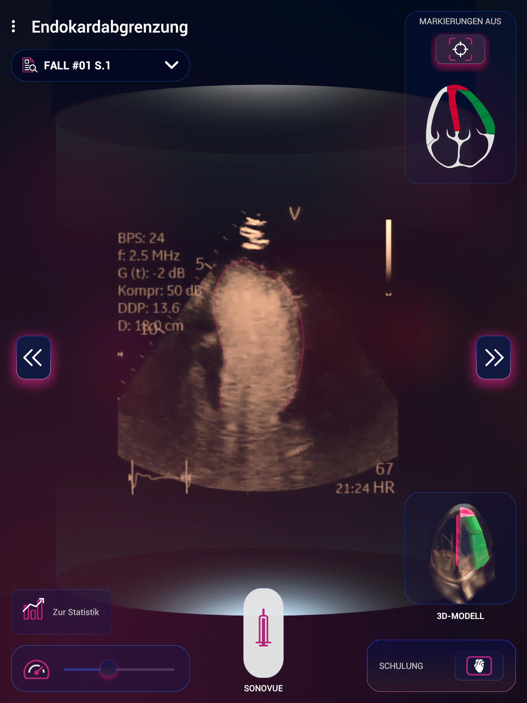 SonoVue screenshot 10