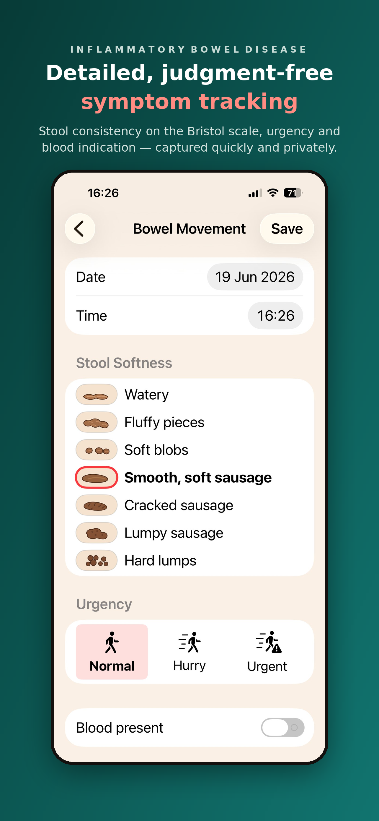 My IBD Tracker