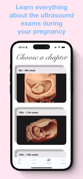 ScanBaby learn baby ultrasoundのスクリーンショット（7/8）