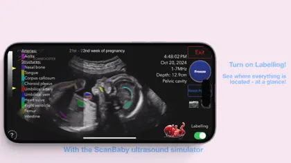 Screenshot 6 di 6 di ScanBaby learn baby ultrasound