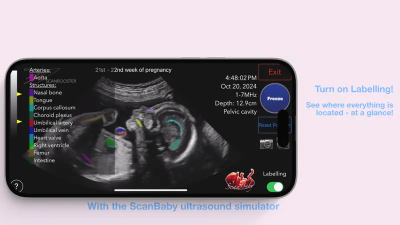 ScanBaby learn baby ultrasound screenshot 6 of 8