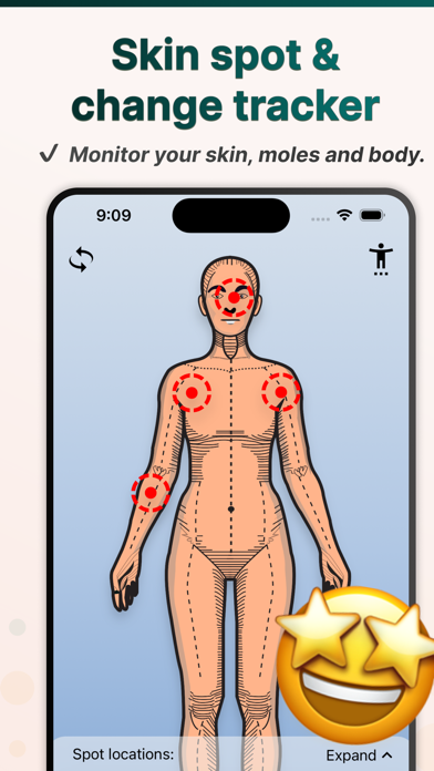 Spots: Moles Acne Skin Tracker Screenshot
