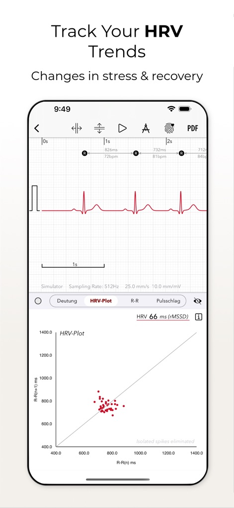 ECG+ | Your Watch ECG Reader - Cet outil visualise la variabilité de la fréquence cardiaque (VFC) via un nuage de points de Poincaré et affiche la valeur rMSSD pour une évaluation objective de la récupération.
