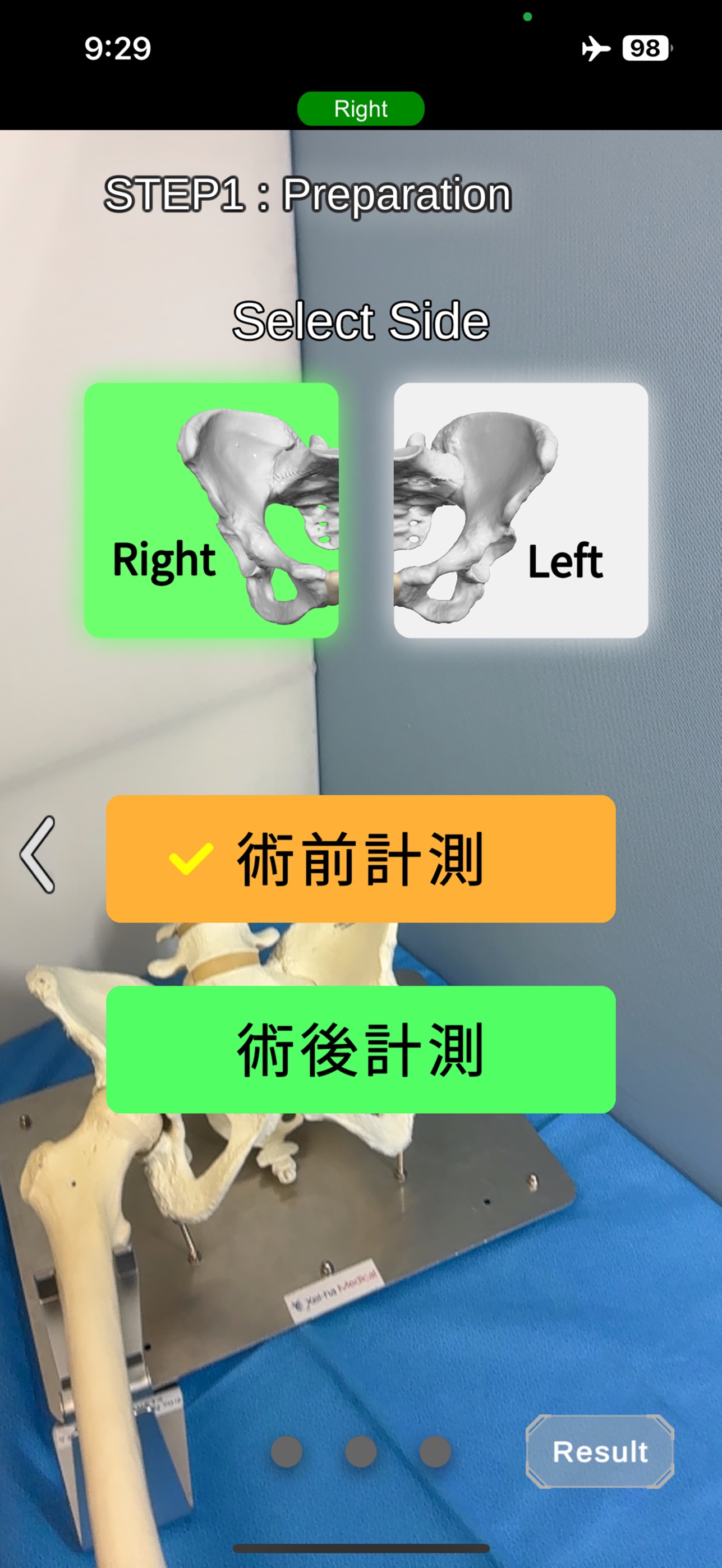 Screenshot 2 of OrthoPanther Leopard