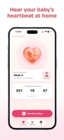 Baby Heartbeat Monitor - Lulla screenshot