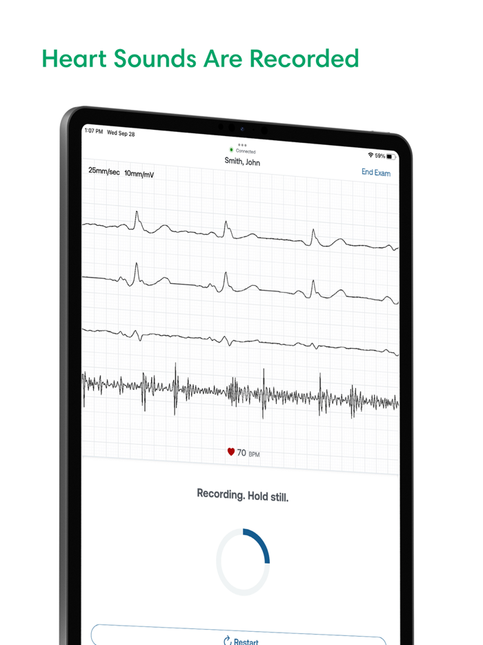 SENSORA™ by Eko Health