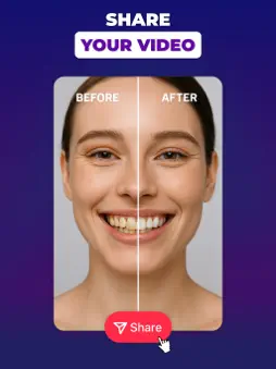 Before After Video Compare Kit screenshot 10