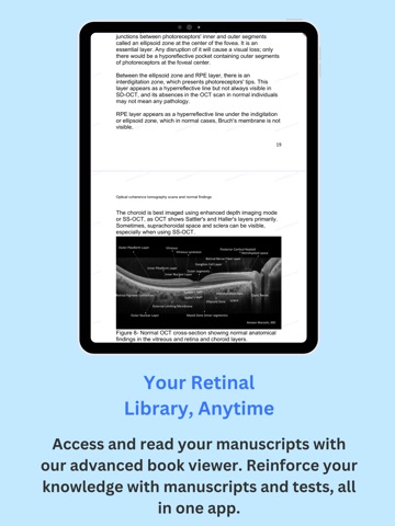 mRetina Books
