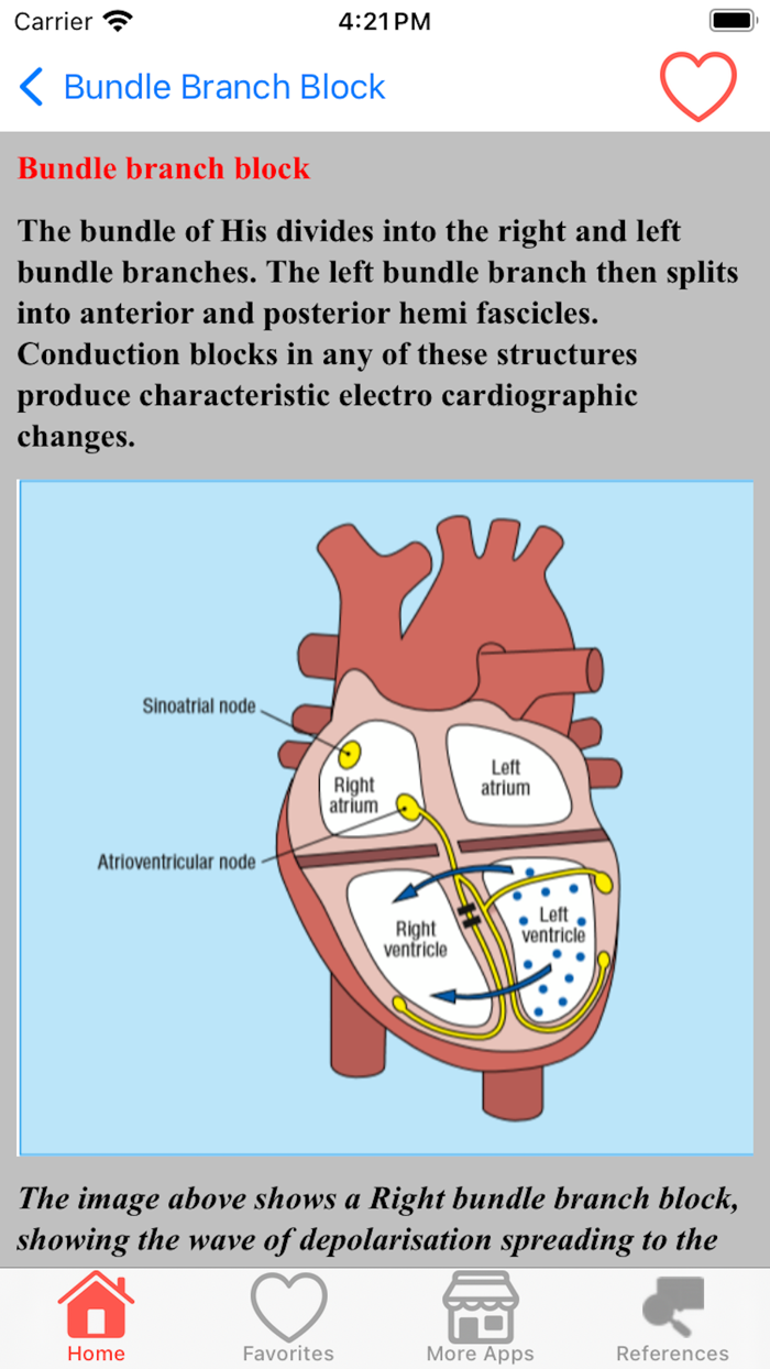 Clinical ECG Interpretation