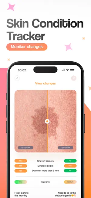 Skin AI - Mole & Derm Scan screenshot 3