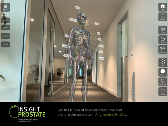 INSIGHT PROSTATE Screenshots
