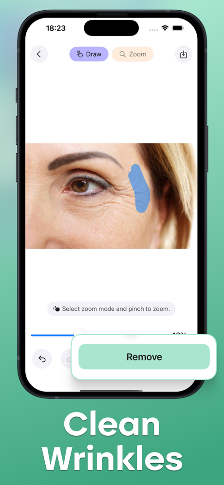 Acne Remover - Pimple Eraser screenshot 5