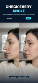 Nose Job - Plastic Surgery AI screenshot