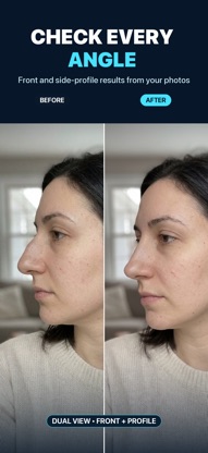 Nose Job - Plastic Surgery AI screenshot 2