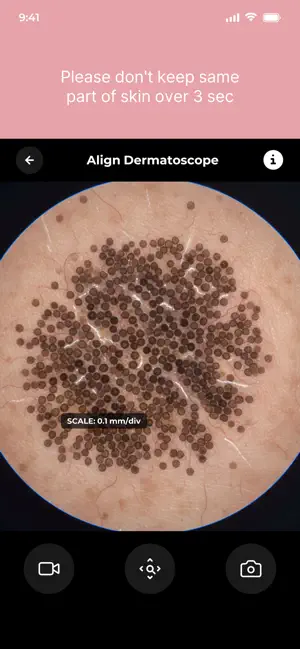 Cecotec Blackhead Remover Pro screenshot 3