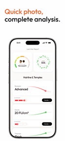 AI Hair Scanner: HairHero screenshot