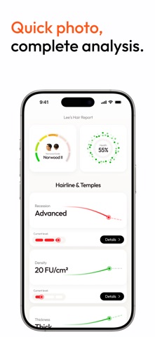 AI Hair Scanner: HairHero screenshot