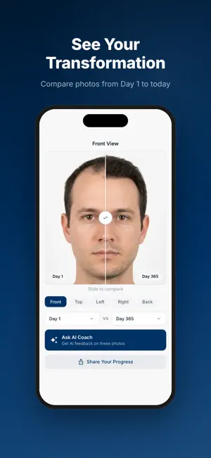 HairGrowth: Transplant Tracker screenshot 2