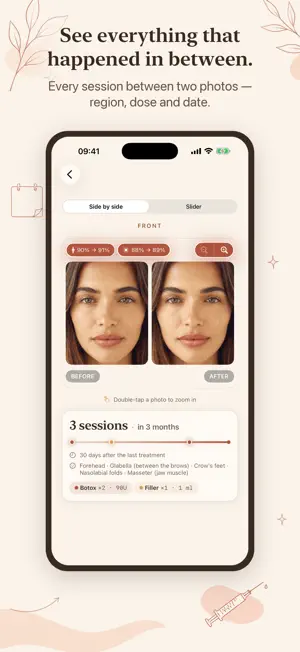 Ruyana: Botox & Filler Tracker screenshot 4