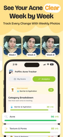 Puffin: Acne Tracker Screenshot 6 of 10