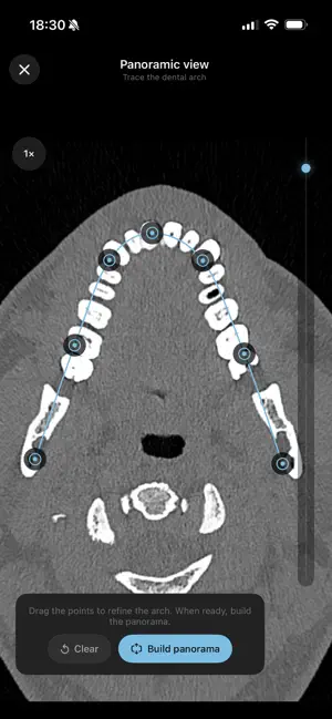 LumaDICOM: CT & MRI Viewer screenshot 4