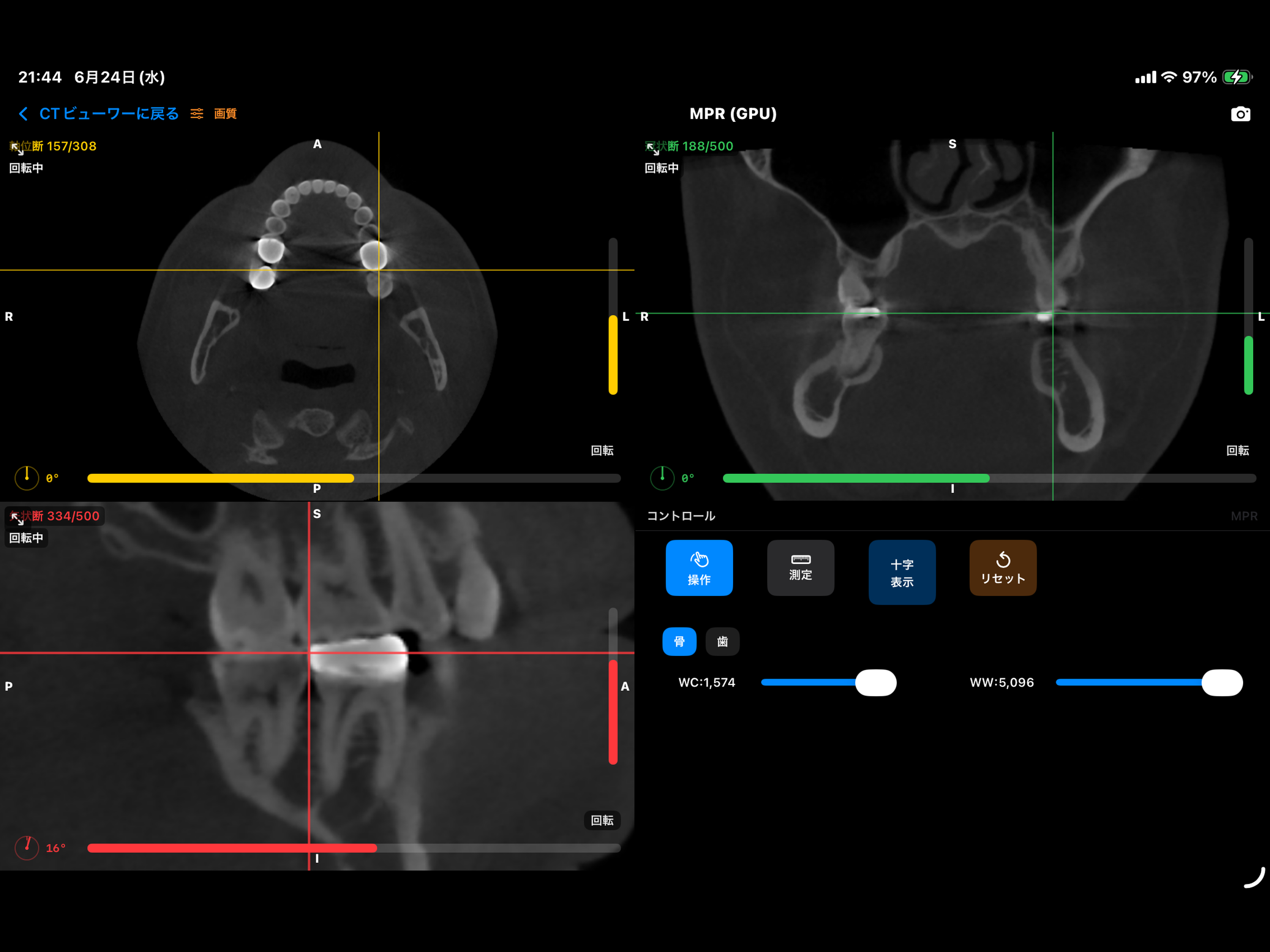 DentalCT screenshot 4