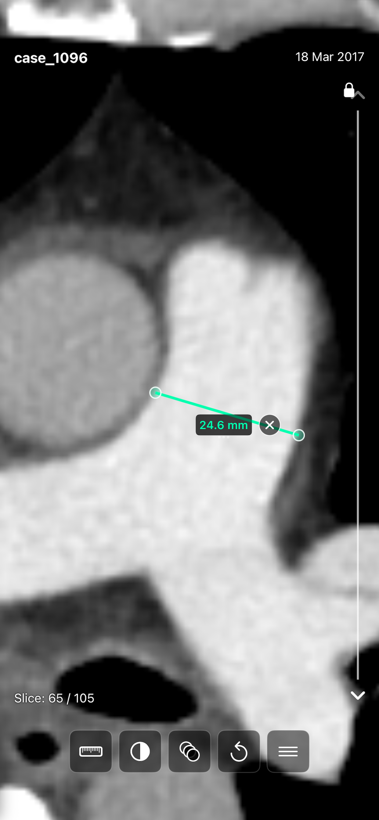 ScalarMetrics DICOM Viewer screenshot 7